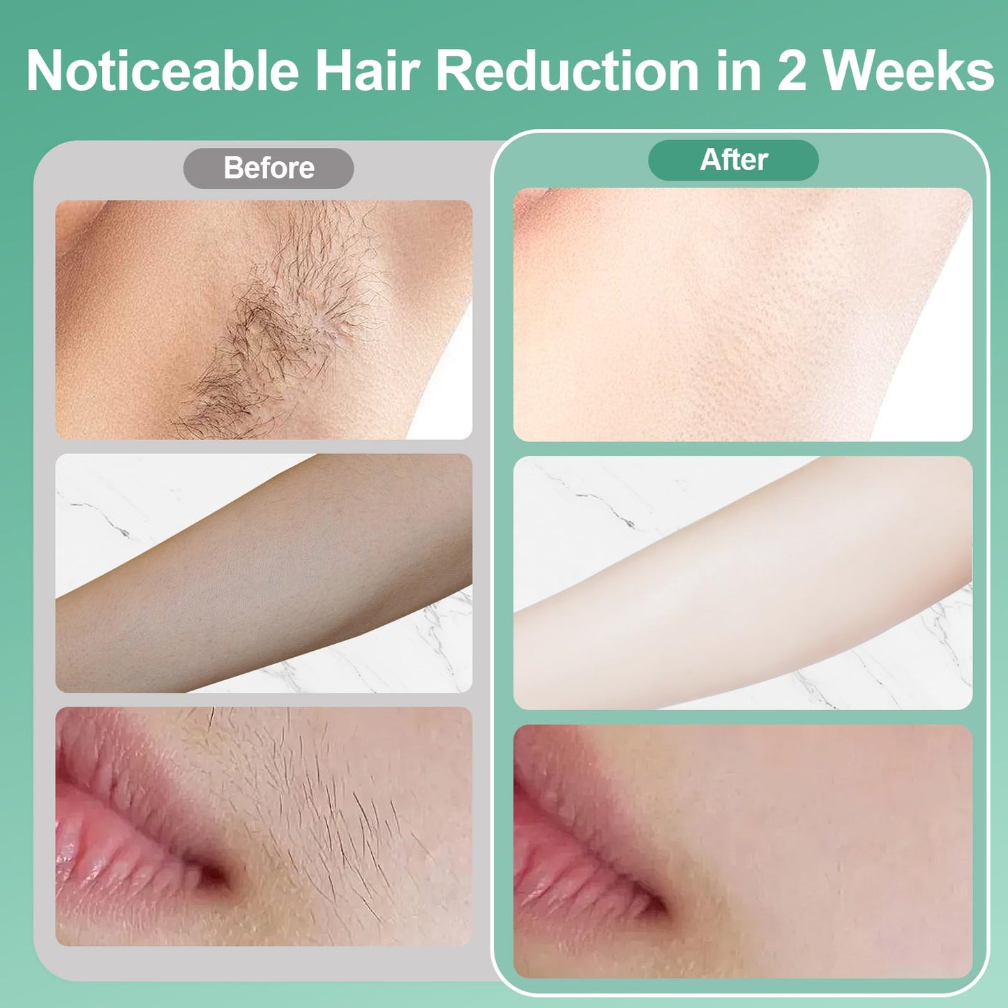 Lovsheme Laser Hair Removal, IPL Laser Hair Removal for Women and Men, 32°F Sapphire Ice Cooling System, Laser Hair Removal Device At Home, Almost Permanent Painless Whole Body Hair Removal