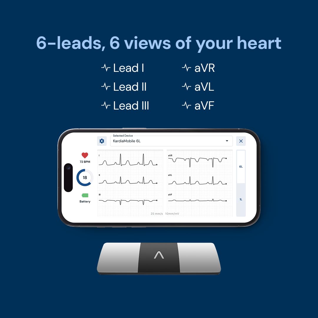 AliveCor KardiaMobile 6-Lead Personal EKG Monitor – Six Views of The Heart – Detects AFib and Irregular Arrhythmias – Instant Results in 30 Seconds – Works with Most Smartphones