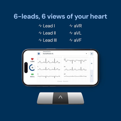 AliveCor KardiaMobile 6-Lead Personal EKG Monitor – Six Views of The Heart – Detects AFib and Irregular Arrhythmias – Instant Results in 30 Seconds – Works with Most Smartphones
