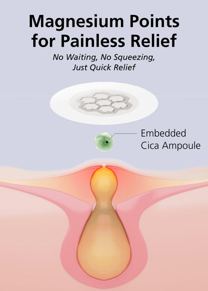 DWEasyDerm Quick Calming Magnesium Patches(20 patches) with Cica Ampoule - Intensive Care, Pimple patches, Hydrocolloid Band, Zits Spot care Overnight Home Care 2-8 hours, New boxs types