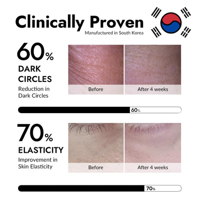 Gel Collagen Patches Under Eye Masks Treatment with 24K Gold and Snail, for Puffy Eye, Pads/Bags for Dark Circles , Anti Wrinkle, Moisturizing Improves Elasticity 30 PAIRS (Gold & Snail)