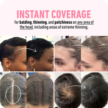 BOLDIFY Hairline Powder - Root Touch Up Hair Color for Gray Coverage - Bald Spot Concealing Hair Powder for Women & Men - 48-Hour Stain-Proof - Dark Brown