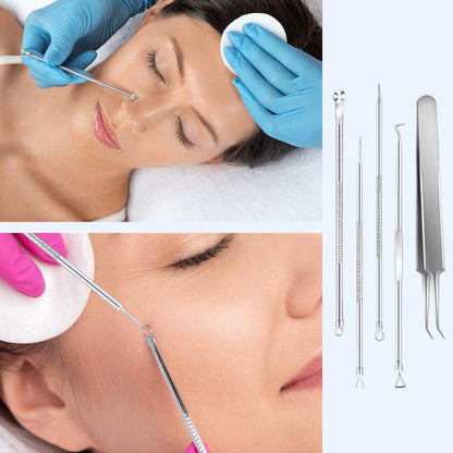 Blackhead Remover Tool Pimple Popper Tool Kit 5 Pack Blackhead Extractor Tools with Case Comedone Zit Acne Blemish Whitehead Removal Kit Professional Stainless Steel Extractor Tools for Face Nose