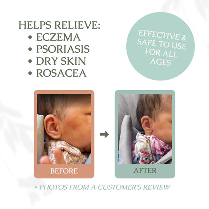 Hearth and Homestead: Handmade Whipped Tallow Balm (Unscented/Herb-Infused) - Organic Body Butter with Infused Olive Oil, for Eczema, Rosacea, Baby - 1.3 oz