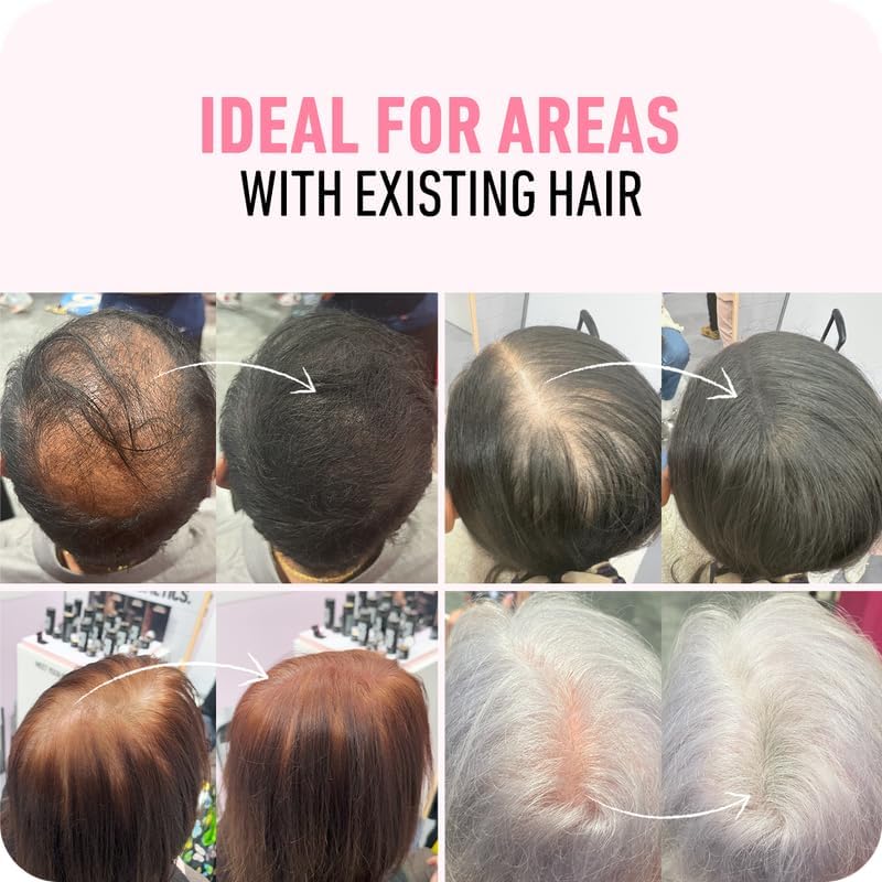 BOLDIFY Hair Fibers (12g) - Fill In Thinning and Fine Hair for an Instantly Fuller, Thicker Look - 14 Shades for Women & Men - Dark Brown