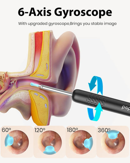 BEBIRD R1 Ear Wax Removal Tool - Spade Ear Cleaner with Ear Camera, 1080P Ear Scope, Earwax Remover Picker with 10 Replacement Tips Ear Pick with 6 LED Light for Earwax Cleaning, Support iPhone, Black