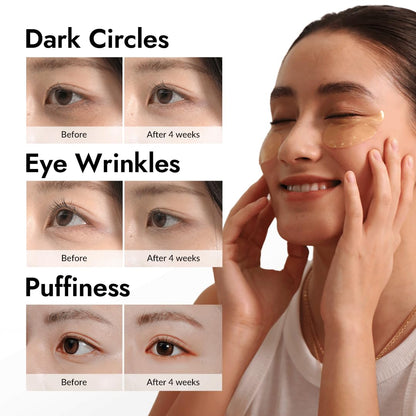 Gel Collagen Patches Under Eye Masks Treatment with 24K Gold and Snail, for Puffy Eye, Pads/Bags for Dark Circles , Anti Wrinkle, Moisturizing Improves Elasticity 30 PAIRS (Gold & Snail)