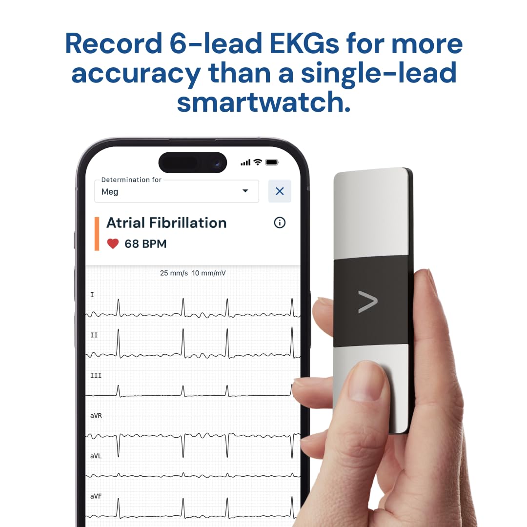 AliveCor KardiaMobile 6-Lead Personal EKG Monitor – Six Views of The Heart – Detects AFib and Irregular Arrhythmias – Instant Results in 30 Seconds – Works with Most Smartphones