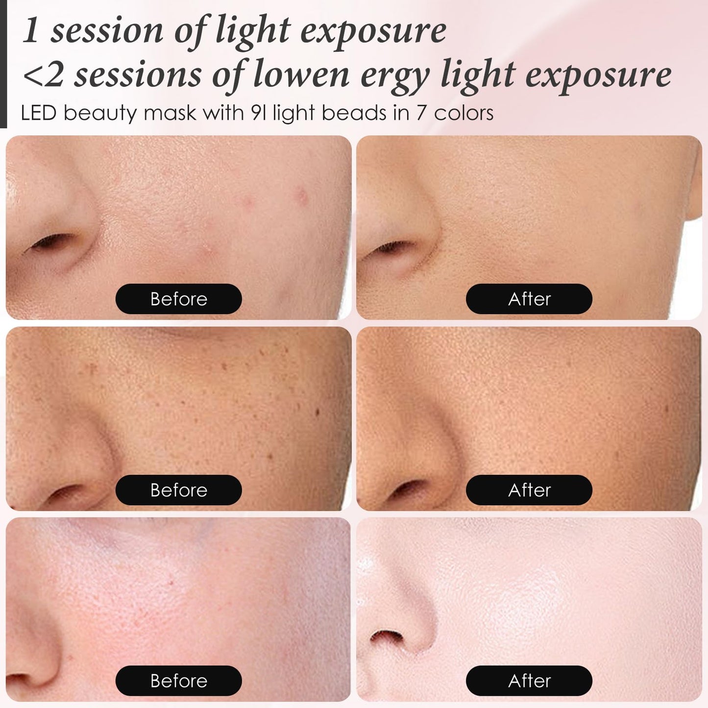 SDKWDH Red Light Therapy for Face, 7 Colors LED Face Mask Light Therapy At Home, Led Face Mask Light Therapy, White