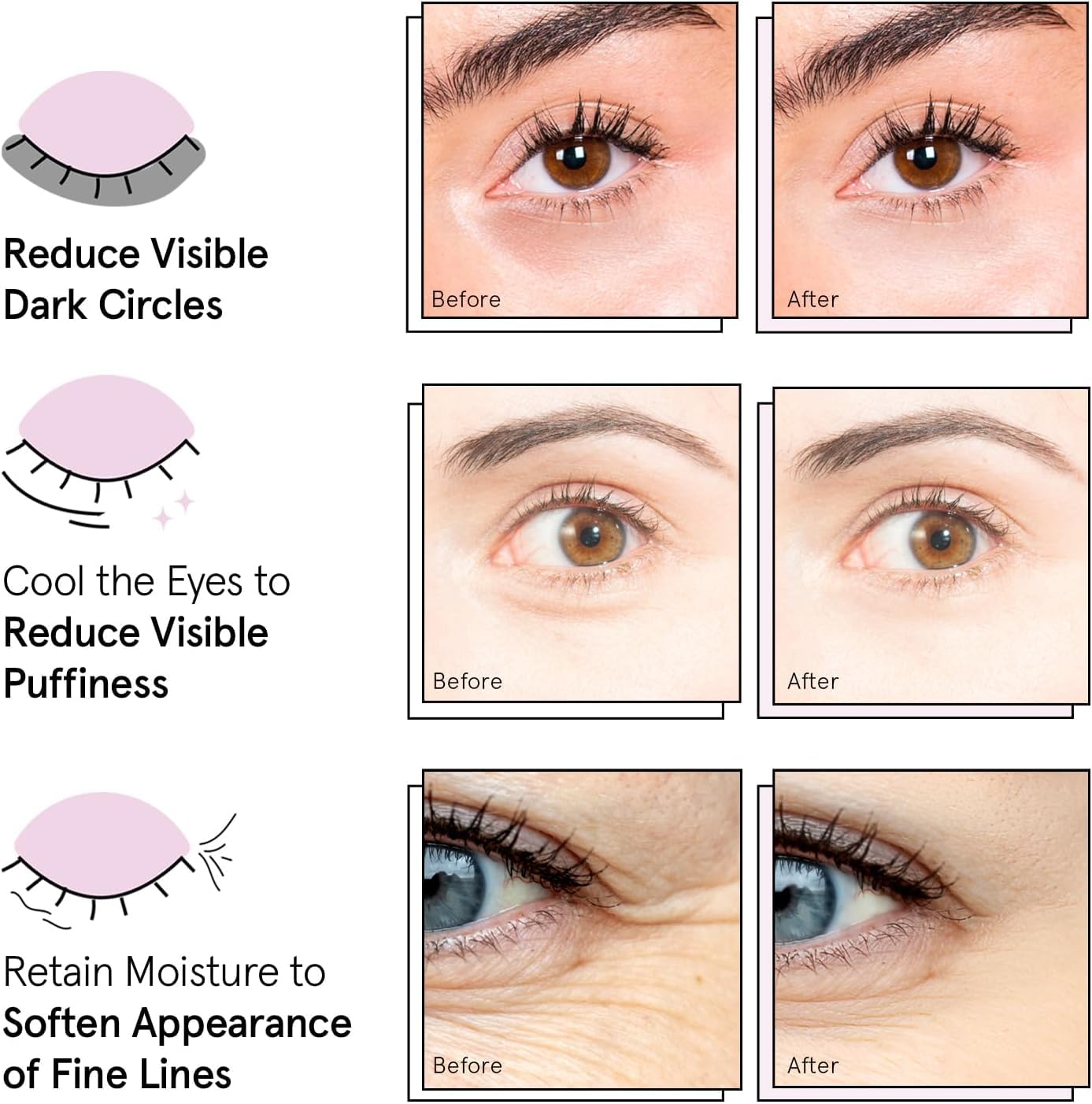 grace & stella Under Eye Patches (12 pairs) Eye Masks for Puffy Eyes and Dark Circles - Valentine Gifts for Women - Gifts for Wife, Bridesmaids, Birthdays, Bachelorette Party, Self Care - Vegan