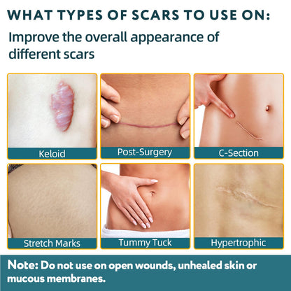 Silicone Scar Sheets, Silicone Scar Tape for Surgical Scars - 60" x 1.6" Roll - 1.5M, Medical Grade Reusable Effective Scar Removal for Keloid, C-Section, Tummy Tuck, and Acne
