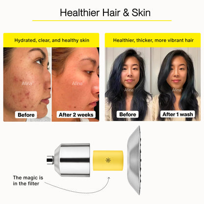 Afina Filtered Shower Head | High Pressure Shower - Reduces Dry Itchy Skin, Dandruff, Eczema, & Dramatically Improves Condition of your Skin, Hair & Nails (Nickel)