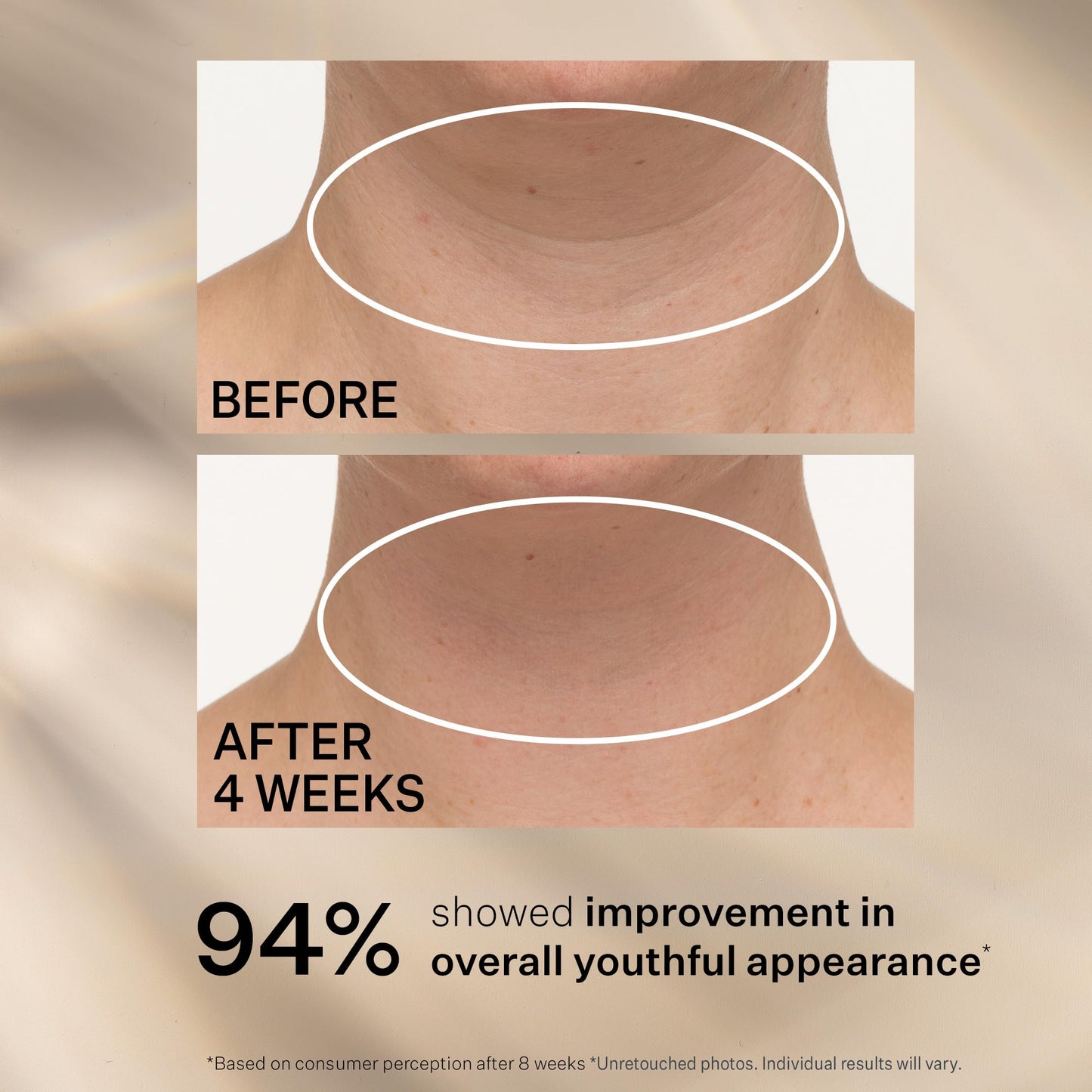 StriVectin Tighten and Lift Advanced Neck Cream PLUS, 3.4 oz for Tightening and Firming Neck and Décolleté Lines, Visibly Reducing Sagging and Crepey Skin for Smooth Healthy Looking Skin