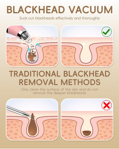 Facial Pore Blackhead Remover Vacuum - Face Cleaner and Blackhead Extractor with 3 Adjustable Suction Levels, 5 Probes, USB Charging Interface - Pore Vacuum Kit for Women&Men (Pink)