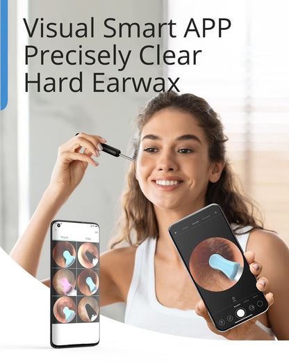 BEBIRD Wax Removal Tool: R1 Upgraded Ear Canal Cleaner with 1080P Camera, Smart Visual Wax Remove Kits with 6 LED Lights & Multi Replacement Tip for Daily Cleaning Ear