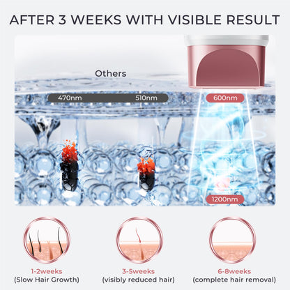 Laser Hair Removal for Women and Men, IPL with Ice-Cooling System for Nearly Painless And Long-Lasting Result At-Home Permanent Hair Removal Device 999999 Flashes for Whole Body Use