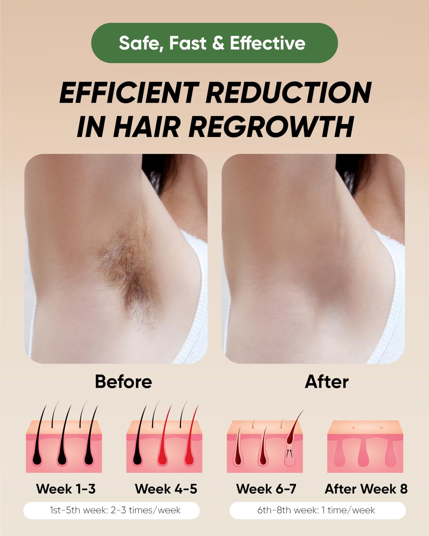 XSOUL At-Home IPL Hair Removal for Women and Men Permanent Hair Removal 999,999 Flashes Painless Hair Remover on Armpits Back Legs Arms Face Bikini Line, Corded