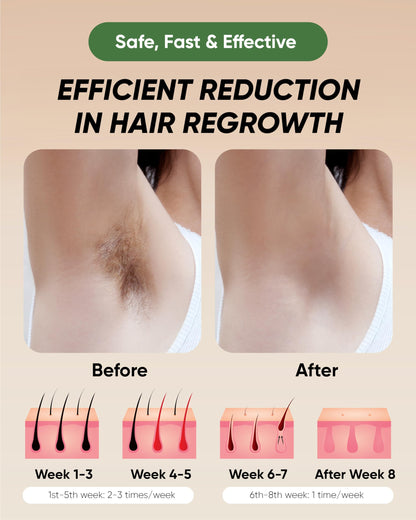 XSOUL At-Home IPL Hair Removal for Women and Men Permanent Hair Removal 999,999 Flashes Painless Hair Remover on Armpits Back Legs Arms Face Bikini Line, Corded