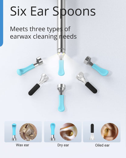 BEBIRD Wax Removal Tool: R1 Upgraded Ear Canal Cleaner with 1080P Camera, Smart Visual Wax Remove Kits with 6 LED Lights & Multi Replacement Tip for Daily Cleaning Ear