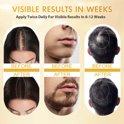 Minoxidil for Men and Women, Hair Growth Biotin Serum with Batana and Rosemary for Hair Beard Regrowth Treatments Extra Strength Hair Loss Solution, Clinically Proven to Regrow Thicker