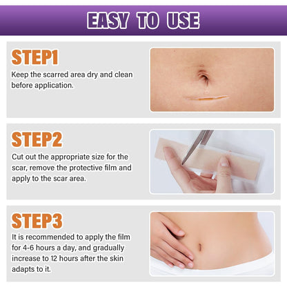 Silicone Scar Sheets,Silicone Scar Tape,Silicone Scar Removal Strips for Surgical,C-Section,Tummy Tuck,Keloid Scars (1.6"X 59" Roll-1.5M) Keloid Bump Removal