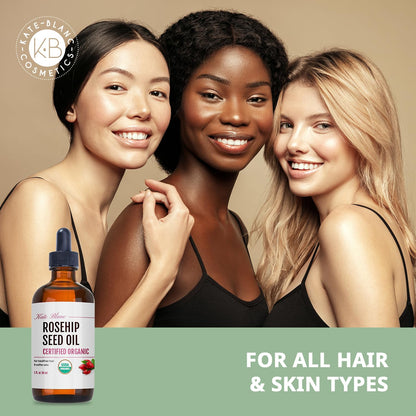 Kate Blanc Cosmetics Rosehip Oil for Face & Softer Glowing Skin (1oz, Organic, Pure, Cold Pressed) Rosehip Seed Face Oil for Facial & Gua Sha Massage