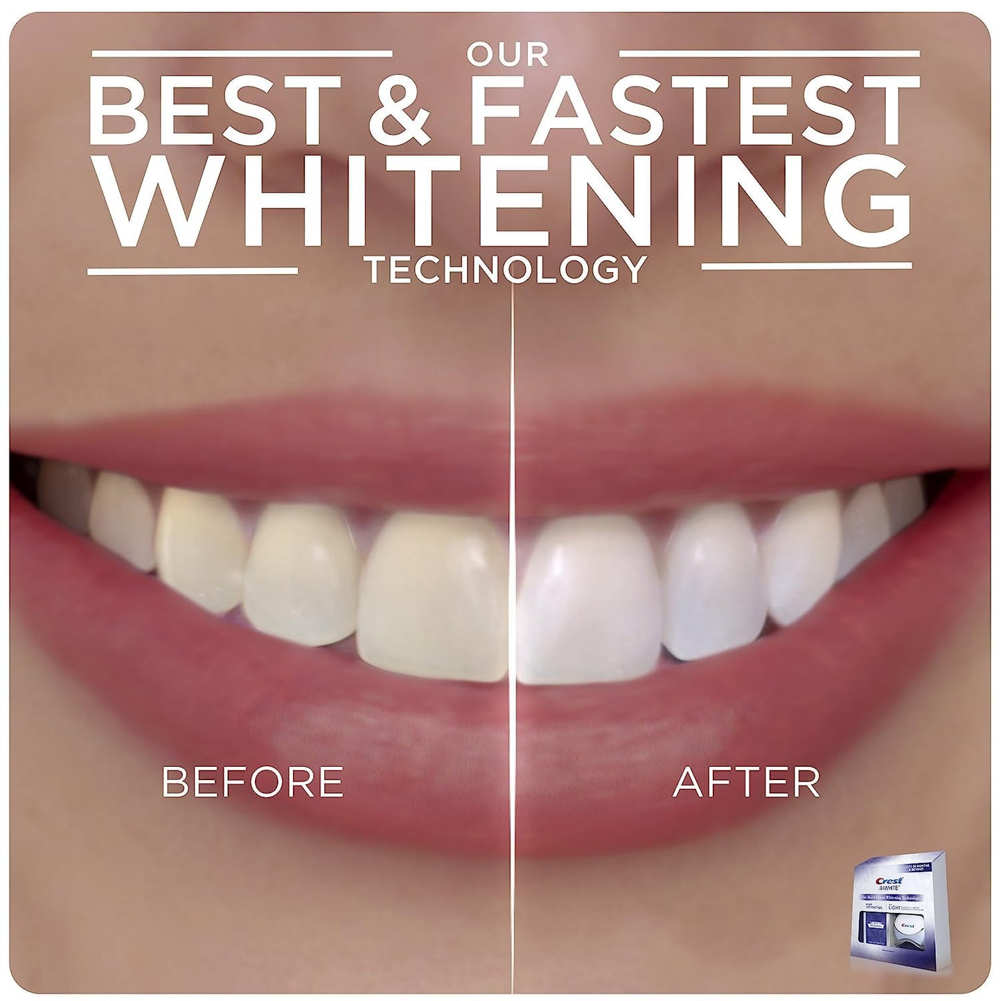 Crest 3D Whitestrips + LED Light – Teeth Whitening Kit, 1 Light + 10 Treatments, Each with 1 Upper/1Lower, 20 Strips – Crest 3DWhite Teeth Whitening Strips