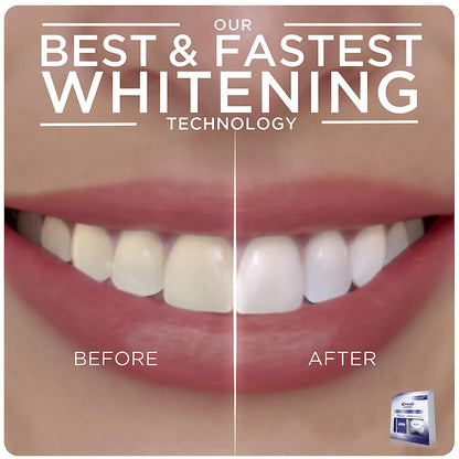 Crest 3D Whitestrips + LED Light – Teeth Whitening Kit, 1 Light + 10 Treatments, Each with 1 Upper/1Lower, 20 Strips – Crest 3DWhite Teeth Whitening Strips