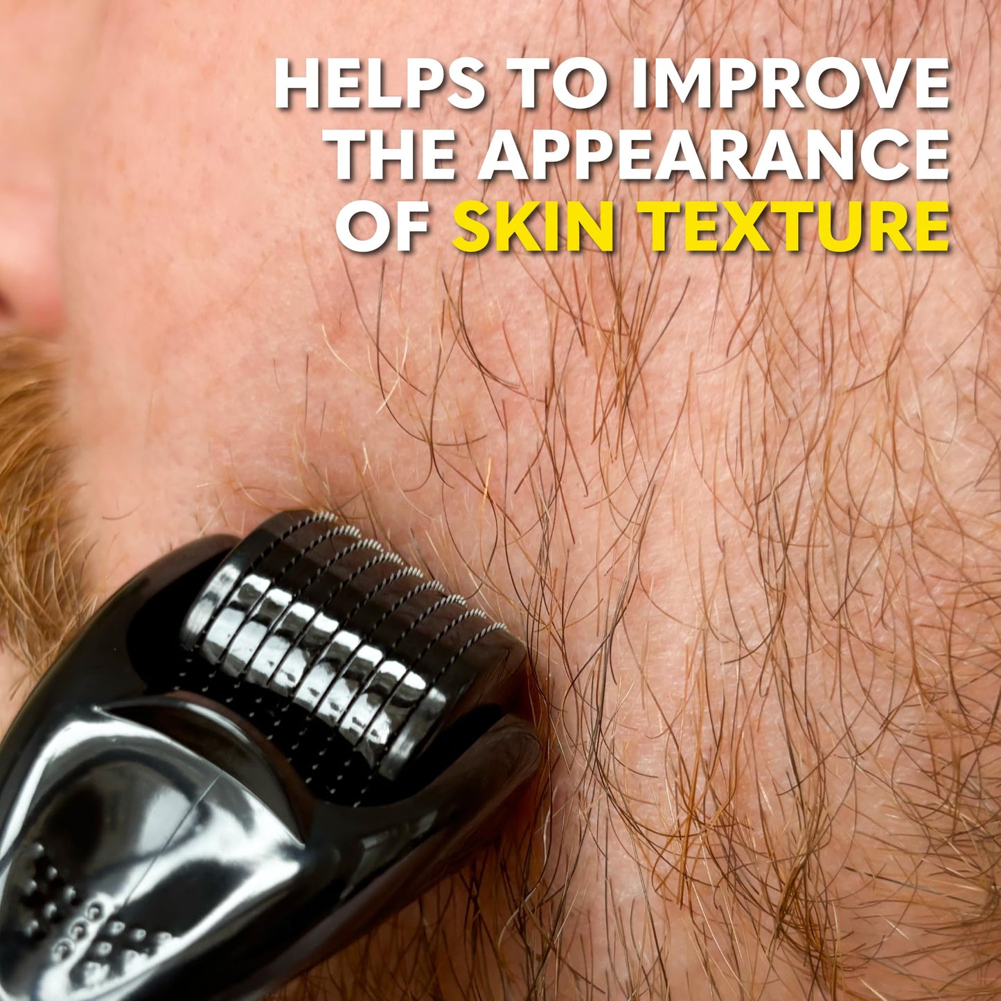 Beard Club Derma Roller for Face, Body and Scalp - Microneedling Roller for Men and Women with 540 Titanium Microneedles - Beard Roller for Hair & Beard