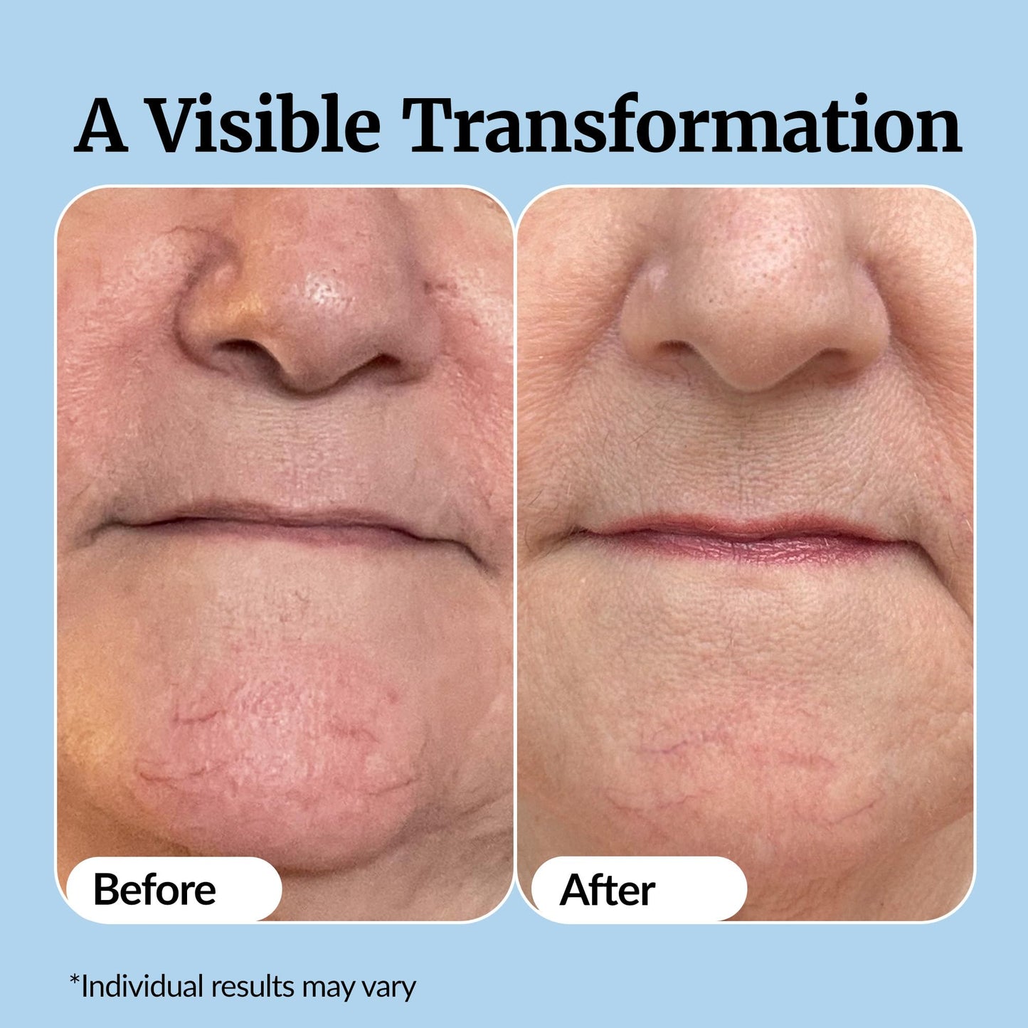 Vibriance Super C Serum for Mature Skin - All-in-One Vitamin Formula Hydrates, Firms, Lifts, Smooths, Targets Age Spots, Wrinkles, 1 fl oz