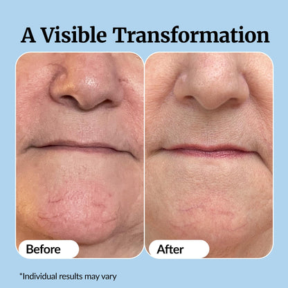 Vibriance Super C Serum for Mature Skin - All-in-One Vitamin Formula Hydrates, Firms, Lifts, Smooths, Targets Age Spots, Wrinkles, 1 fl oz