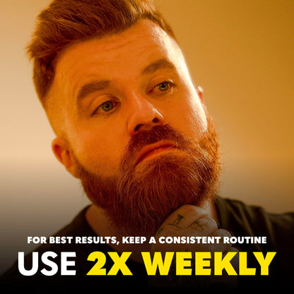 Beard Club Derma Roller for Face, Body and Scalp - Microneedling Roller for Men and Women with 540 Titanium Microneedles - Beard Roller for Hair & Beard