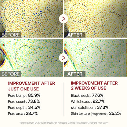 Dr.Melaxin Peel Shot Glow Rice Peeling Ampoule 80ml Daily Soft Exfoliating Face and Body Scrub Dead Skin Cells Blackhead Remover for All Skin Types korean skin care