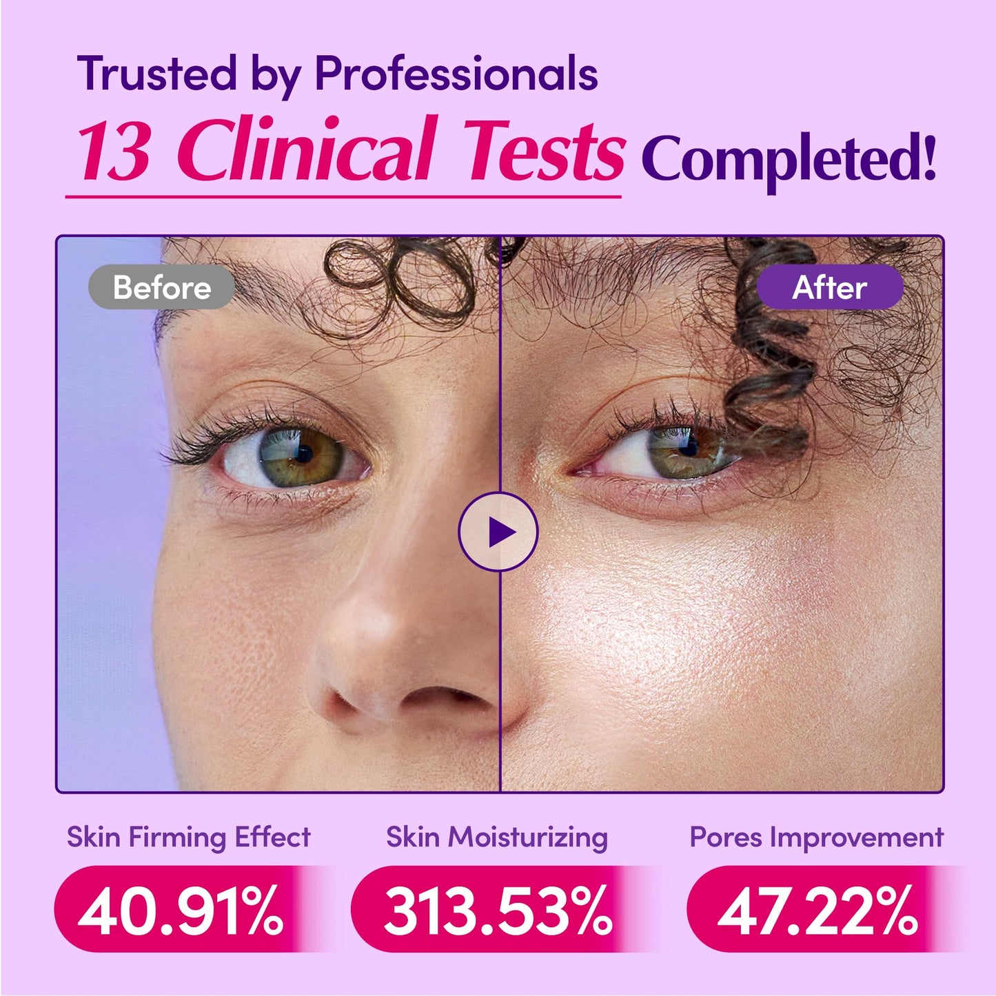 EQQUALBERRY Bakuchiol Plumping Face Serum - Retinol Natural Alternative for Sensitive Skin, with Niacinamide & Hyaluronic Acid, Pore & Wrinkle Korean Skin Care (1.01oz / 30ml)