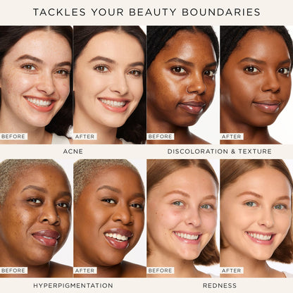 tarte shape tape full-coverage concealer - 22N light neutral (light skin with a balance of warm & cool undertones) - full size