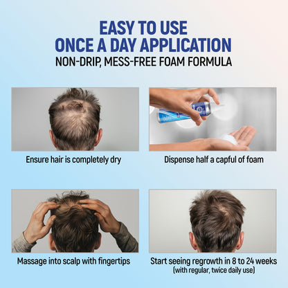 Minoxidil Topical Aerosol Foam, 5%, Hair Regrowth 4 Months Treatment for Men, 2.11 oz (4 Pack)