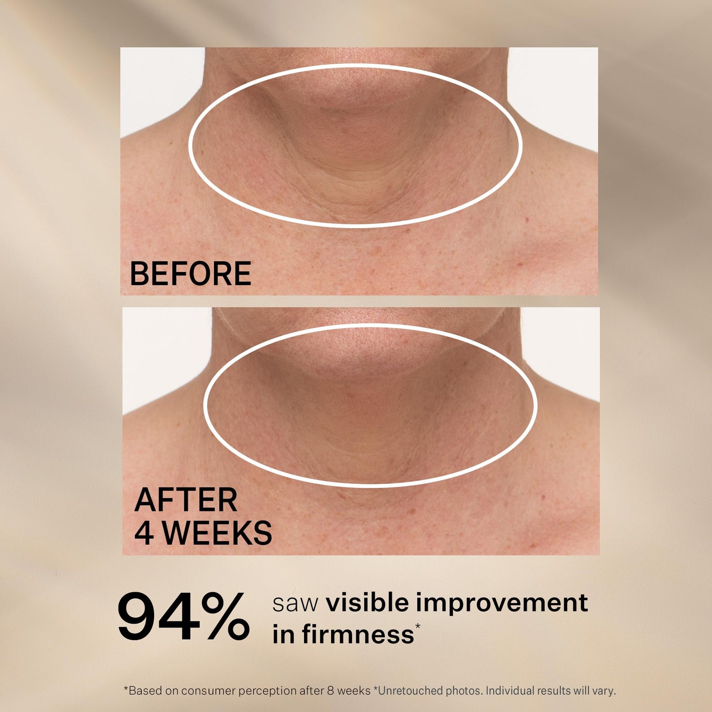 StriVectin Tighten and Lift Advanced Neck Cream PLUS, 3.4 oz for Tightening and Firming Neck and Décolleté Lines, Visibly Reducing Sagging and Crepey Skin for Smooth Healthy Looking Skin