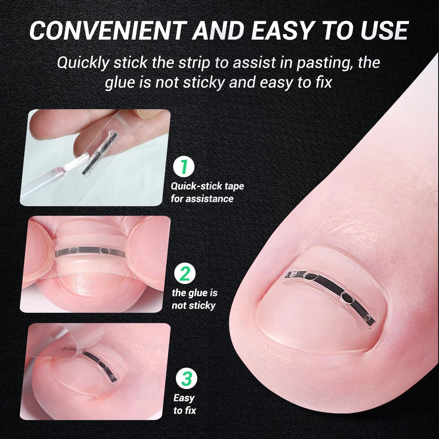 Reieset Titanium Alloy Ingrown Toenail Treatment, Nail Tools, and Ingrown Toenail Removal Kit Specially Designed for Curved Nail Repair and Ingrown Toenail Corrector(0.59/0.67in)