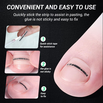 Reieset Titanium Alloy Ingrown Toenail Treatment, Nail Tools, and Ingrown Toenail Removal Kit Specially Designed for Curved Nail Repair and Ingrown Toenail Corrector(0.59/0.67in)