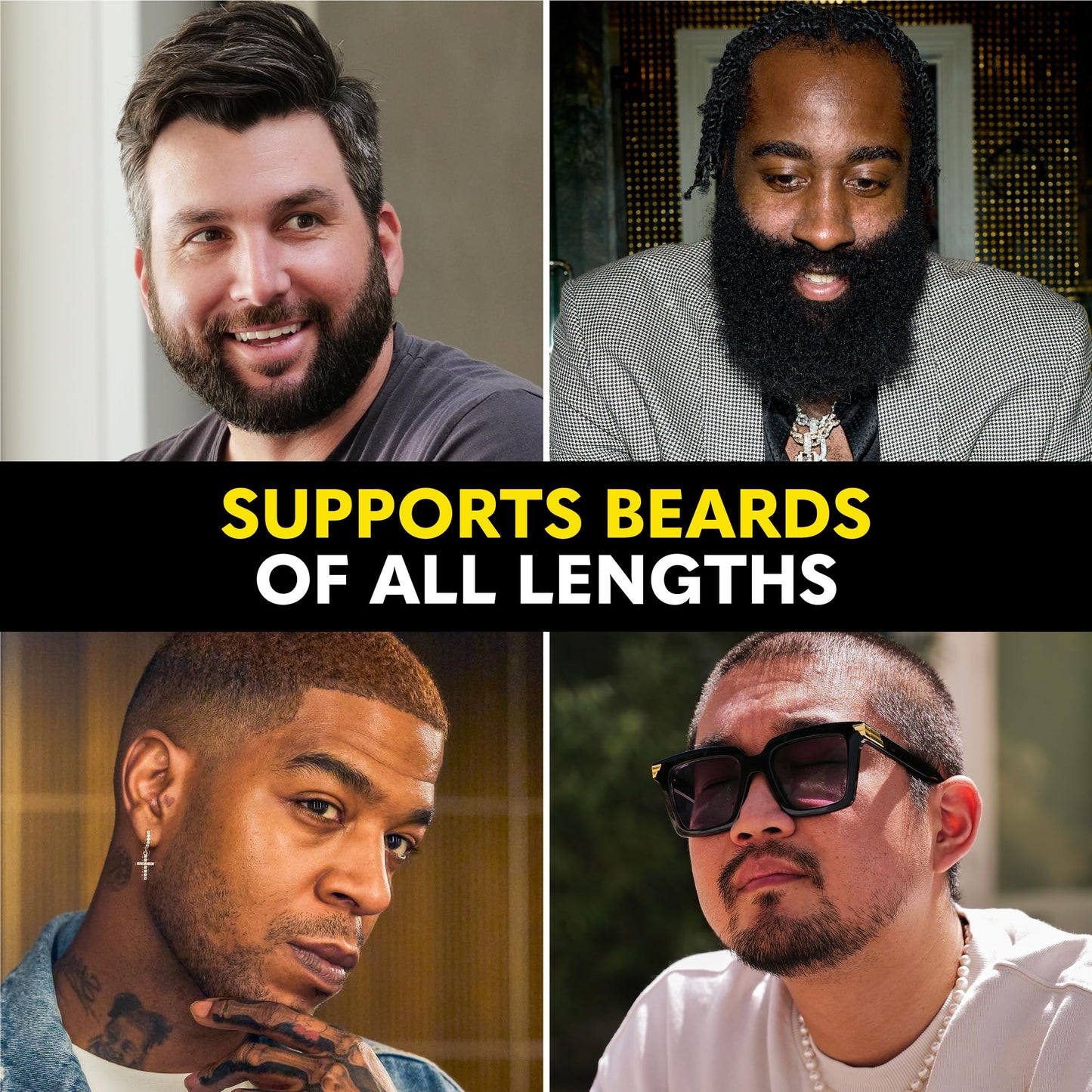 Beard Club Derma Roller for Face, Body and Scalp - Microneedling Roller for Men and Women with 540 Titanium Microneedles - Beard Roller for Hair & Beard