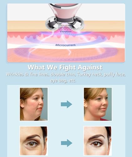 MCSYPOAL Microcurrent-Facial-Device, Microcurrent Face Lift Device, Face Roller for Wrinkles Removal, Face Massager for Skin Tightening, Microcurrent Multifunctional Facial Massager