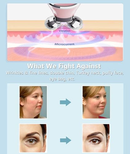 MCSYPOAL Microcurrent-Facial-Device, Microcurrent Face Lift Device, Face Roller for Wrinkles Removal, Face Massager for Skin Tightening, Microcurrent Multifunctional Facial Massager