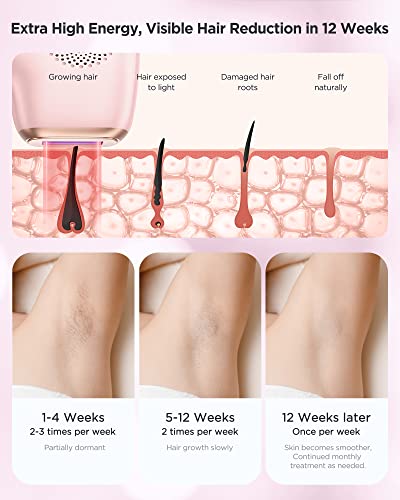 INNZA Laser Hair Removal with Ice Cooling Care Function for Women Permanent,999,999 Flashes Painless IPL Hair Remover, Hair Removal Device for Armpits Legs Arms Bikini Line (Rose Gold)