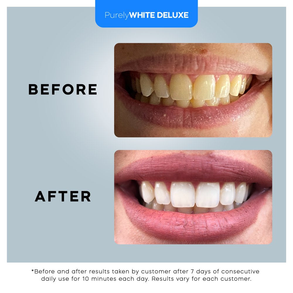 PurelyWHITE DELUXE Teeth Whitening Kit, Complete LED Teeth Whitening, 15+ Treatments, Whiter Smile In 7 Minutes