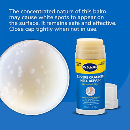 Dr. Scholl’s Severe Cracked Heel Repair Restoring Balm 2.5oz, with 25% Urea for Dry, Cracked Feet, Heals and Moisturizes for Healthy Looking Feet, Foot Care, Epsom Salt Soothes, Safe for Diabetics